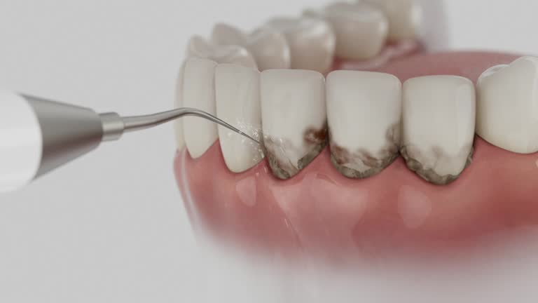 Reliable Root Canal Treatment contractor in Martin County County, KY by Dentist Open Now